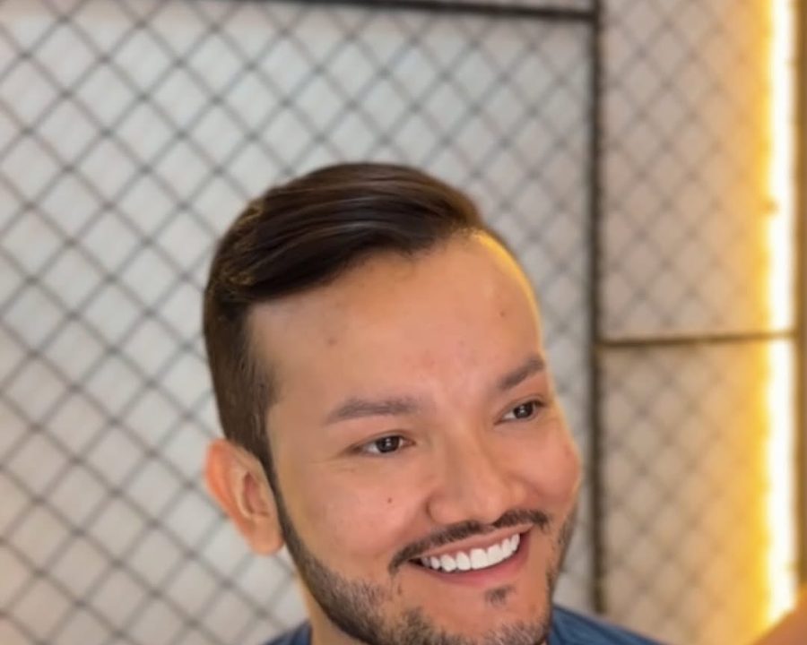 Barba Terapia